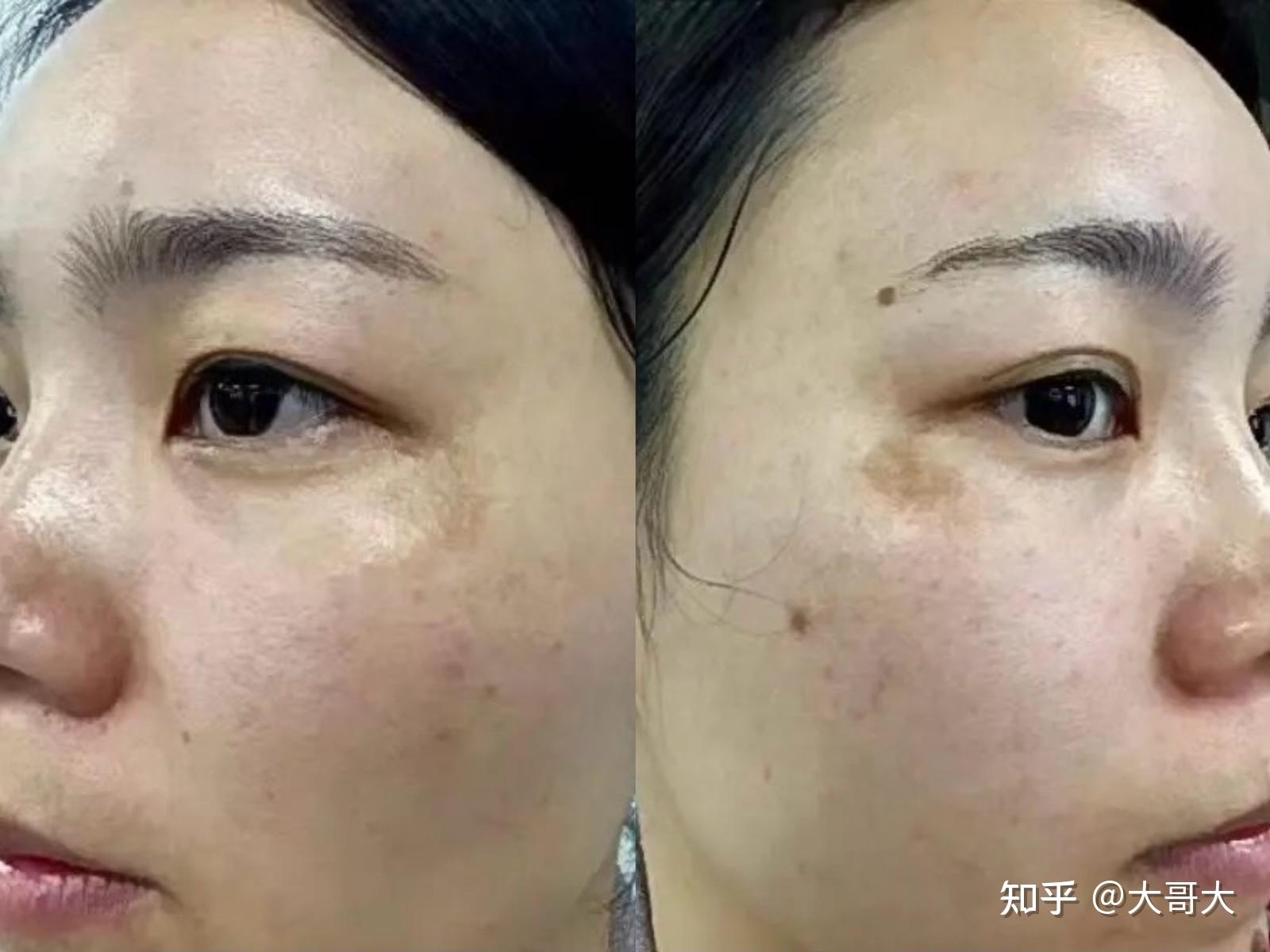 最新捕捉斑現(xiàn)象，多維視角深度解析